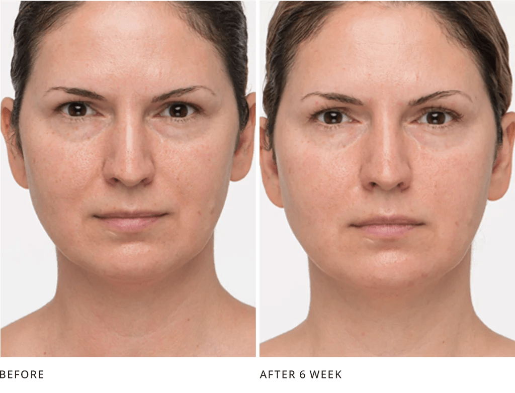 Your Eyes Look Refreshed, Less Hooded - Joanna Vargas